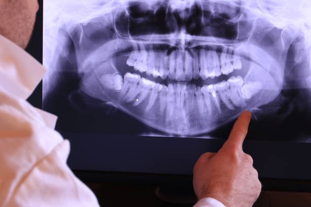 Best Chipped Tooth Repair Near Me  in Lucerne Valley, CA