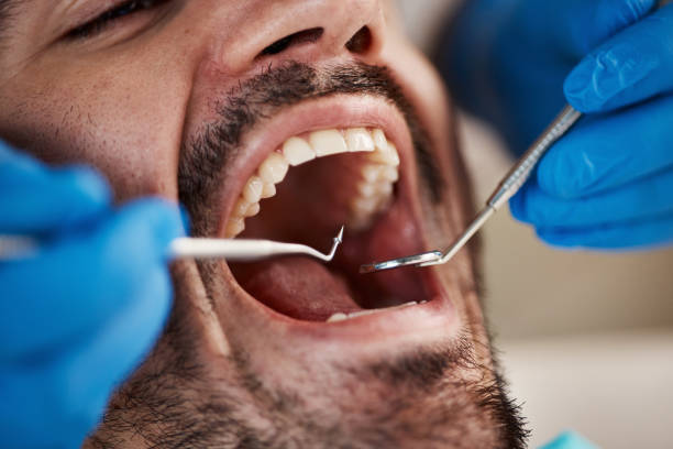 Best Walk-In Dentist Near Me  in Lucerne Valley, CA